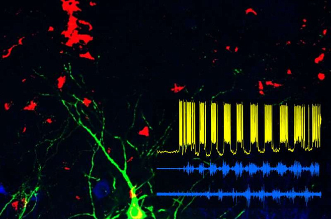 Выявлены нейроны, отвечающие за способность к передвижению