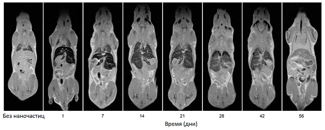 Изучено старение контрастных наночастиц для МРТ в организме