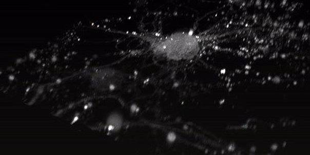 Создан биосенсор для мониторинга кальциевого обмена в клетках