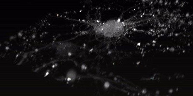 Создан биосенсор для мониторинга кальциевого обмена в клетках