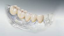 Установлена причина сложности интеграции пломб в ткань зуба