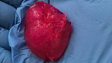 Биотехнологи напечатали миниатюрную модель человеческого сердца