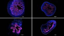 Биологи смогли вырастить органоиды кишечника в суспензии