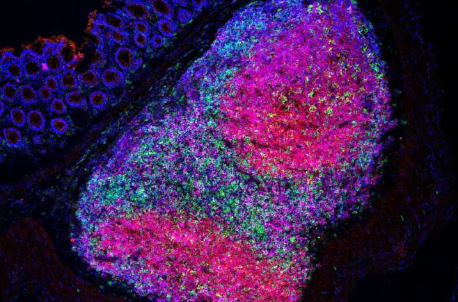 Кишечные бактерии провоцируют иммунный ответ на рак