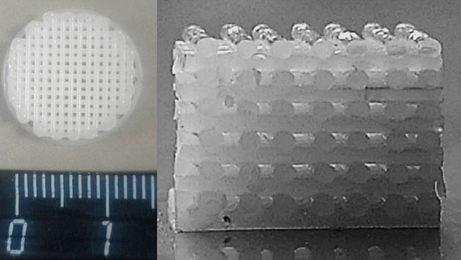 Напечатанные на 3D-принтере биоразлагаемые пластиковые имплантаты восстановили поврежденную костную ткань