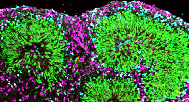 Учёные измерили элекрические колебания органоидов мозга