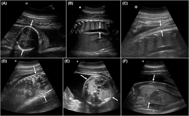 Впервые получены УЗИ-снимки беременной самки дельфина. Они одновременно прекрасны и трагичны