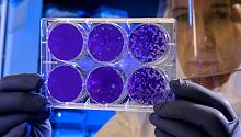Наноиголки защитят импланты от бактерий  — ученые 