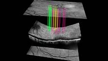 ИИ предсказывает опасную глазную болезнь за 3 года до появления симптомов 