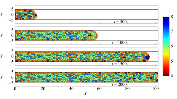 Ученые ПНИПУ выяснили, как геометрия пор в имплантате влияет на скорость регенерации кости