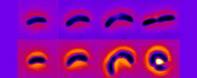 Бактерии научились менять форму, чтобы устоять перед антибиотиками 