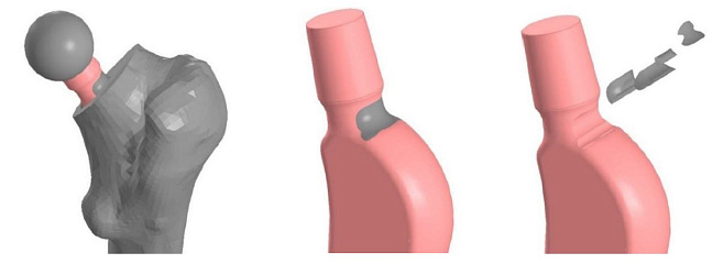 Ученые Пермского Политеха разработали уникальную модель для предсказания «старения» углеродных имплантатов тазобедренного сустава