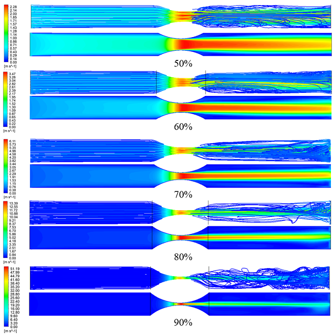 Ученые Пермского Политеха впервые выяснили, как сужение сосудов позвоночной артерии влияет на кровоснабжение мозга