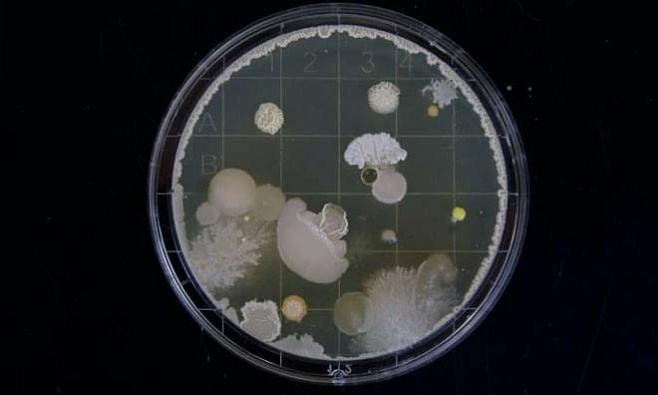 Обнаружен ранее не изученный механизм, благодаря которому бактерии сопротивляются действию иммунитета